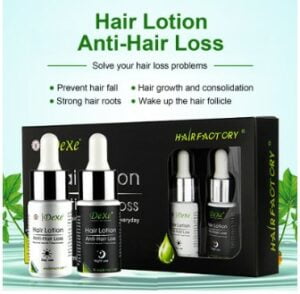 Best anti hair loss lotion